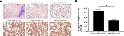 Plasma Exosome-Derived Sentrin SUMO-Specific Protease 1: A Prognostic Biomarker in Patients With Osteosarcoma